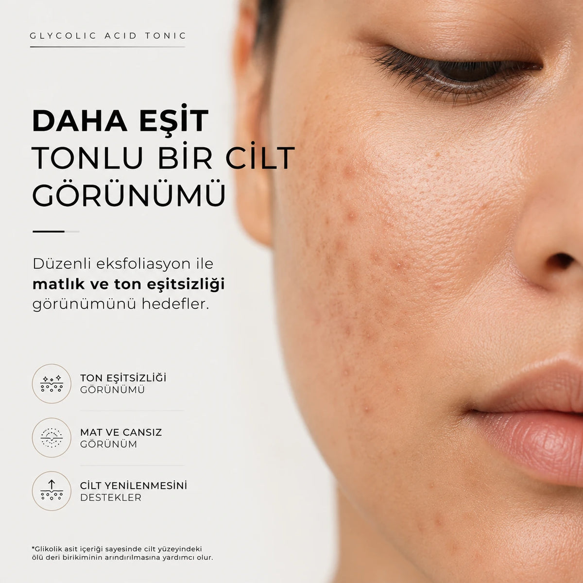 Ton eşitsizliği görünümü olan cilt ve Glycolic Acid Tonic