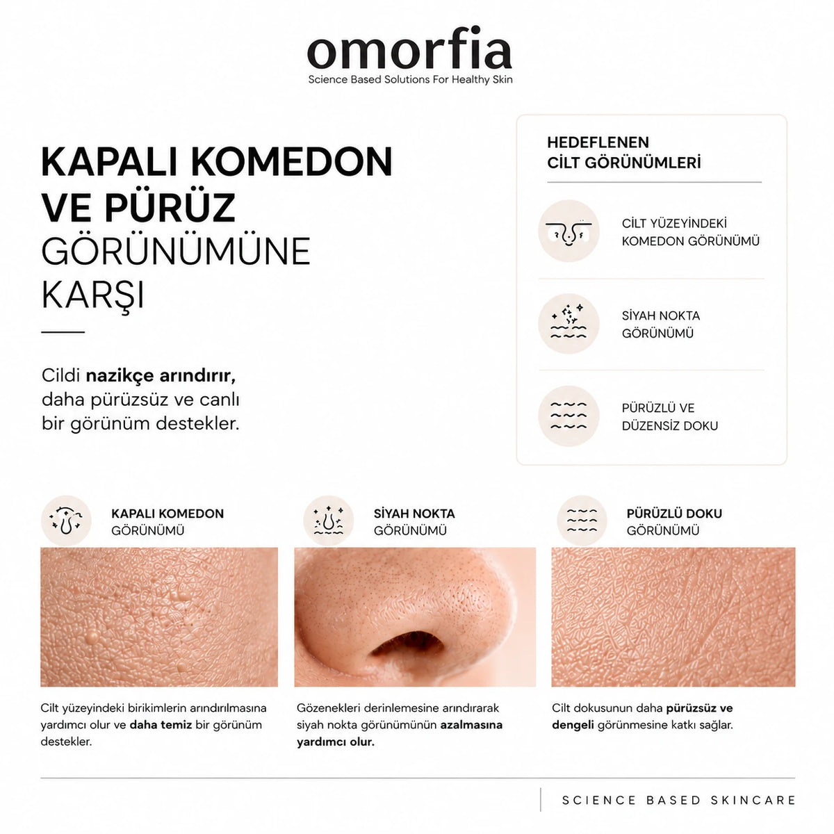 Ginseng Peeling hedeflenen cilt görünümleri: kapalı komedon, siyah nokta ve pürüzlü doku