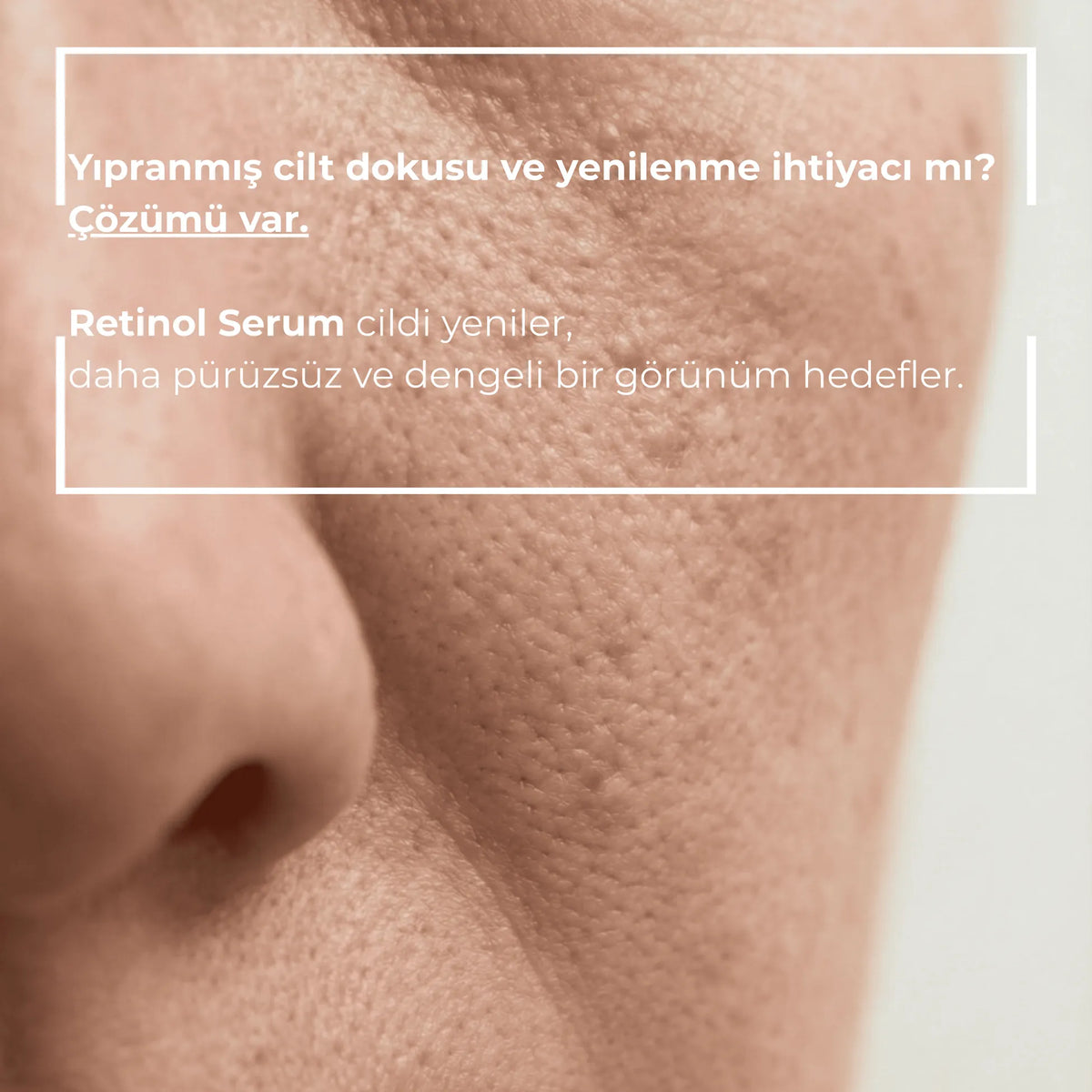 Cilt dokusunun yakın çekimi