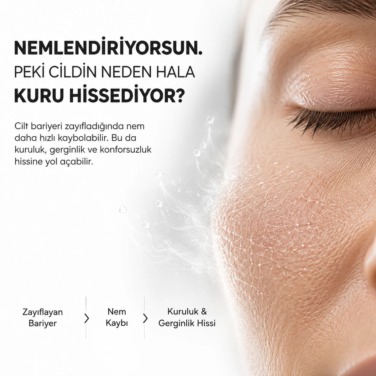 Kuruluk ve gerginlik hissi yaşayan cildin yakın çekimi