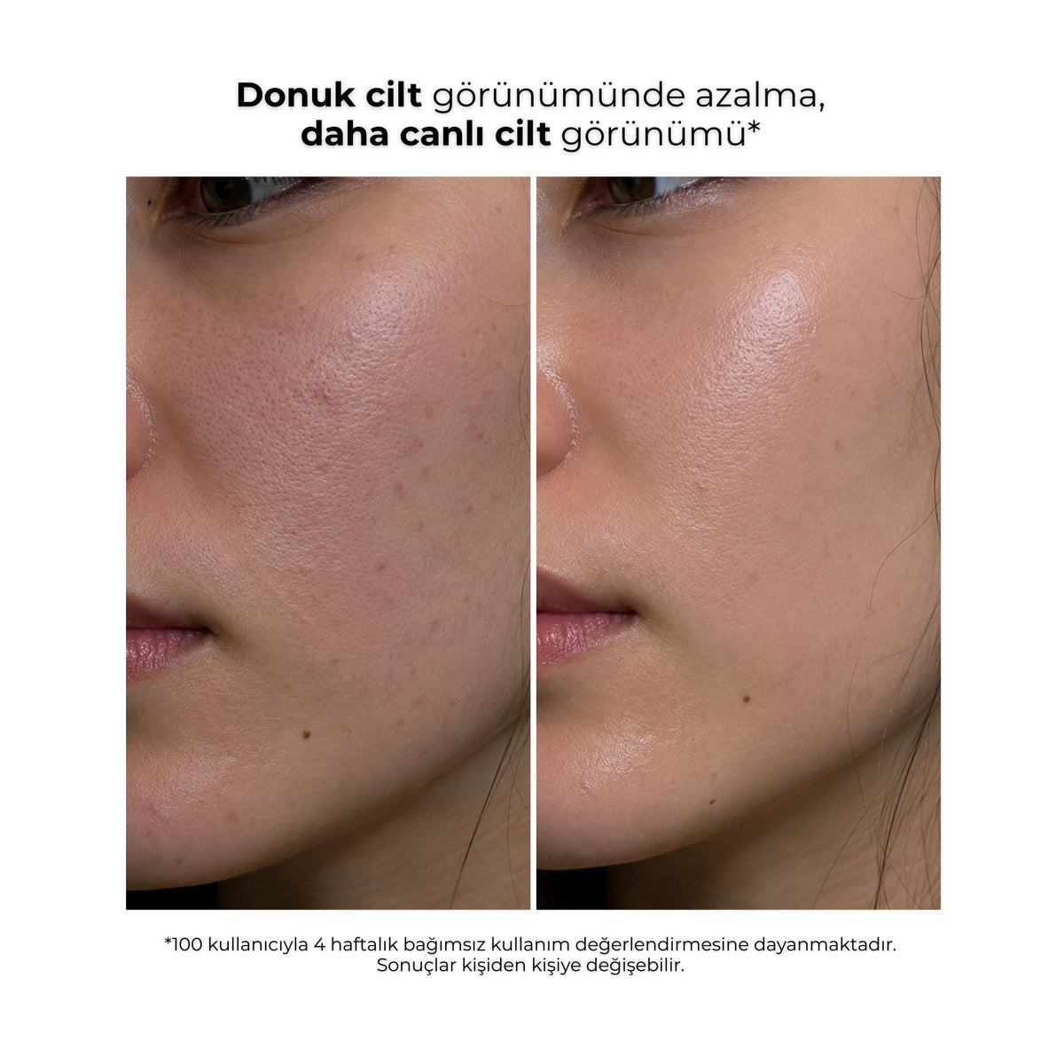 Ginseng Peeling kullanıcısının önce ve sonra cilt görünümü
