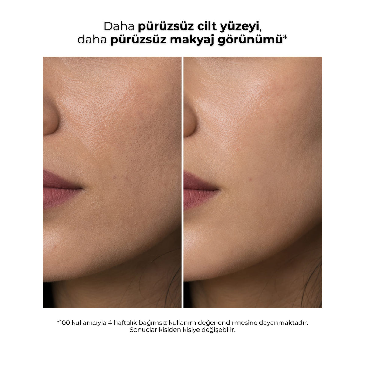 Ginseng Peeling kullanıcısının önce ve sonra cilt yüzeyi