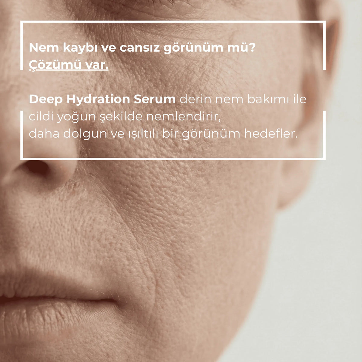 Nem kaybı yaşayan cildin yakın çekimi